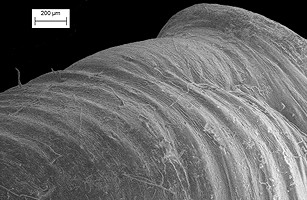 Millerelix plicata (Say, 1821) Cumberland Liptooth Scanning Electron Micrographs