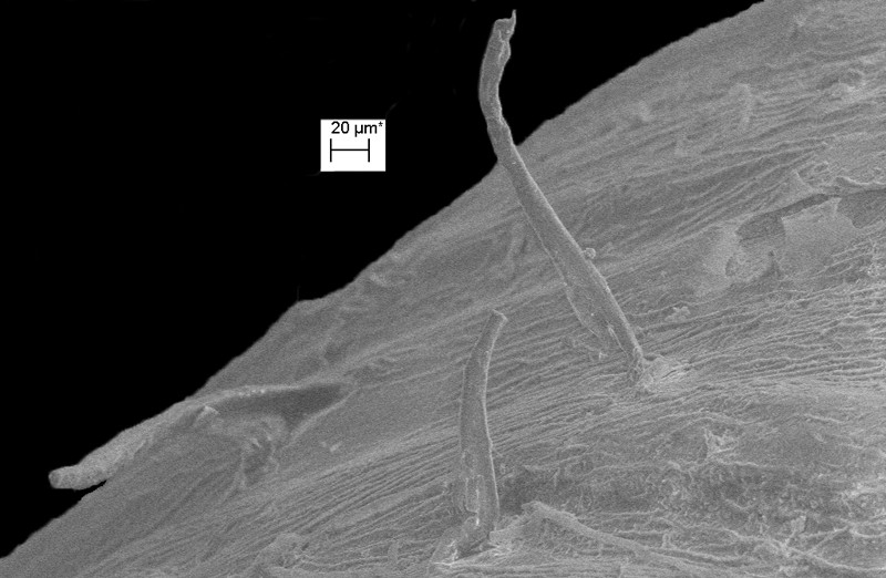 Millerelix plicata (Say, 1821) Cumberland Liptooth Scanning Electron Micrograph