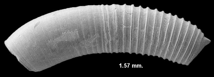 Caecum bipartitum de Folin, 1870 Bipartite Caecum