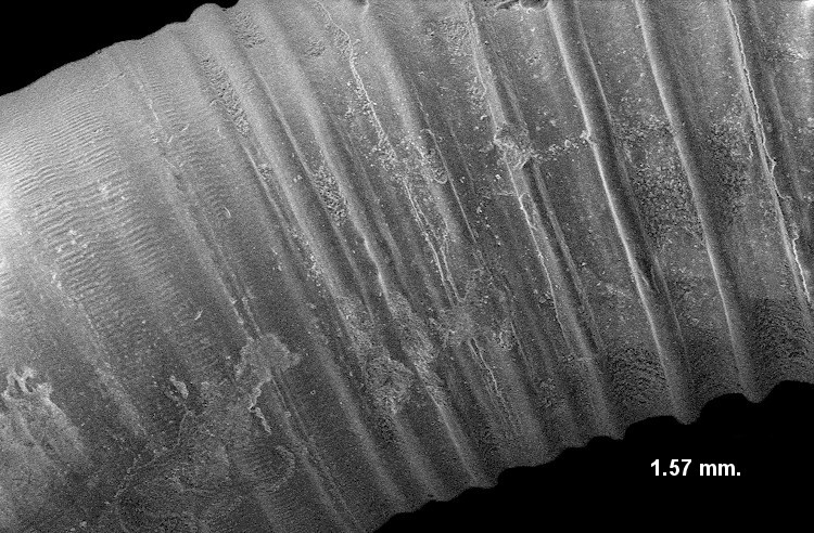 Caecum bipartitum de Folin, 1870 Bipartite Caecum