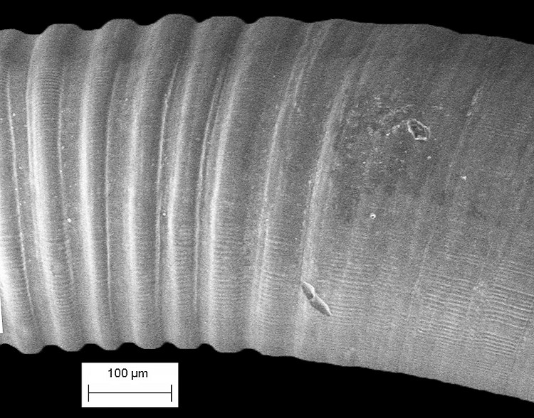 Caecum bipartitum de Folin, 1870 Bipartite Caecum