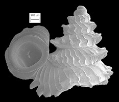 Opisthostoma concinnum Fulton, 1901 Scanning Electron Micrograph