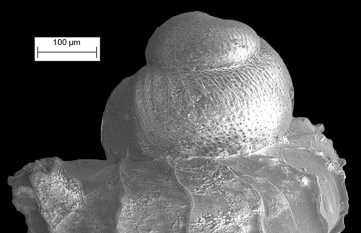 Opisthostoma concinnum Fulton, 1901 Scanning Electron Micrograph