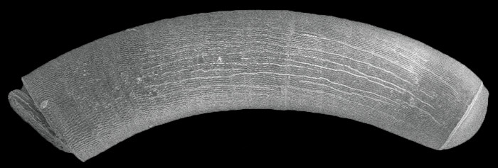 Caecum infimum de Folin, 1867