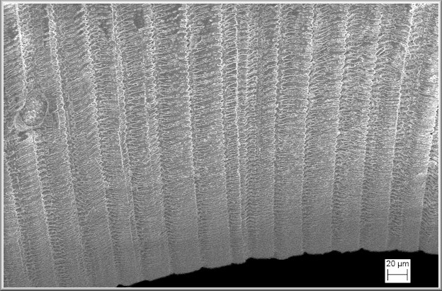 Caecum gurgulio Carpenter, 1858 Windpipe Caecum - Scanning Electron Micrograph