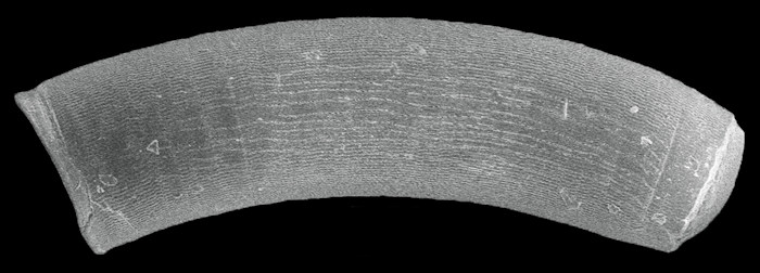 Caecum infimum de Folin, 1867