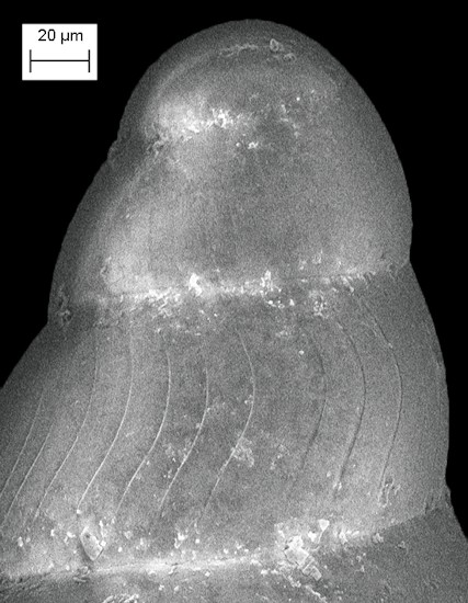 Ersilia stancyki Warn, 1980 Brittlestar Snail