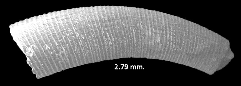 Caecum textile de Folin, 1867 Textile Caecum Scanning Electron Micrograph