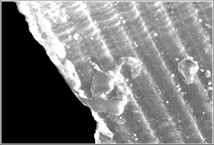 Caecum textile de Folin, 1867 Textile Caecum Scanning Electron Micrograph