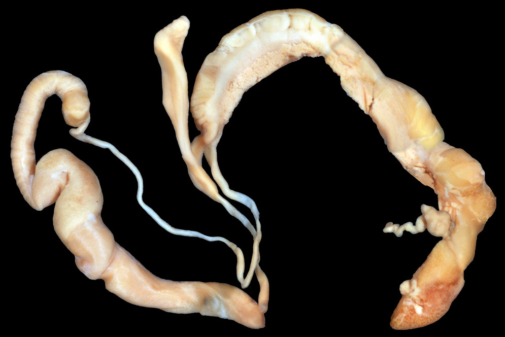 Daedalochila auriculata (Say, 1818) Ocala Liptooth Dissection