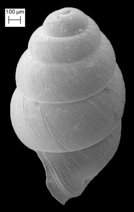 Vertigo tridentata Wolf, 1870 Honey Vertigo Scanning Electron Micrographs (SEM)