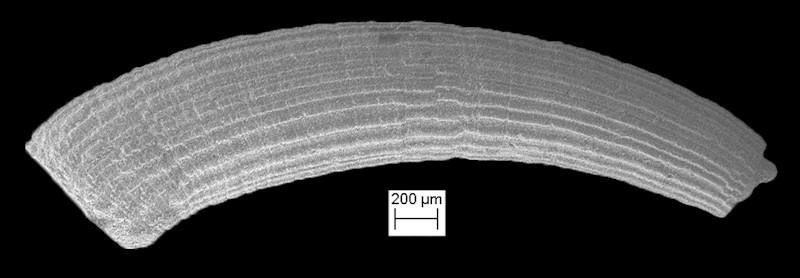 Caecum zaagmani de Jong and Coomans, 1988 Scanning Electron Micrograph